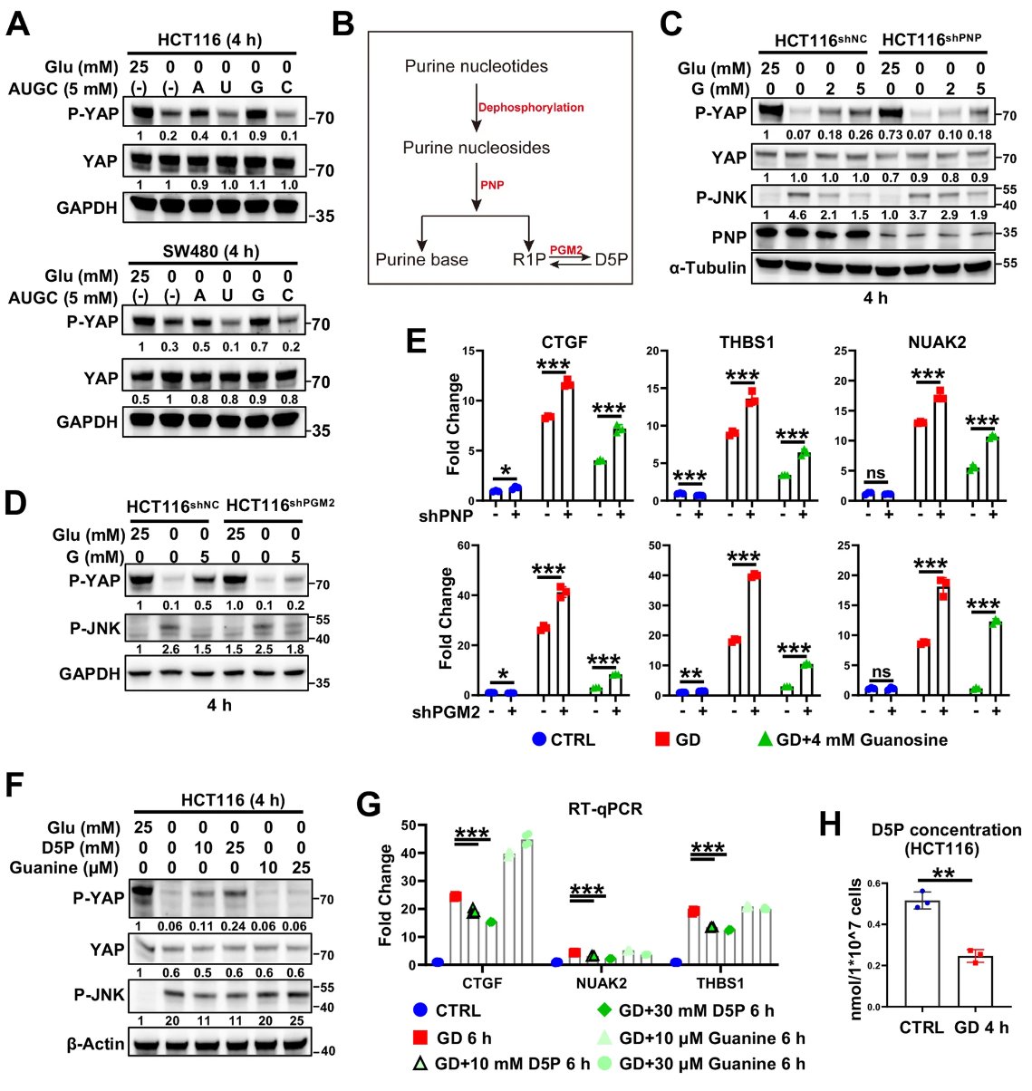 癌症代谢治疗新突破:D-核糖-5-磷酸如何“关闭”促癌蛋白YAP? 3 1751876712991_8106296.png