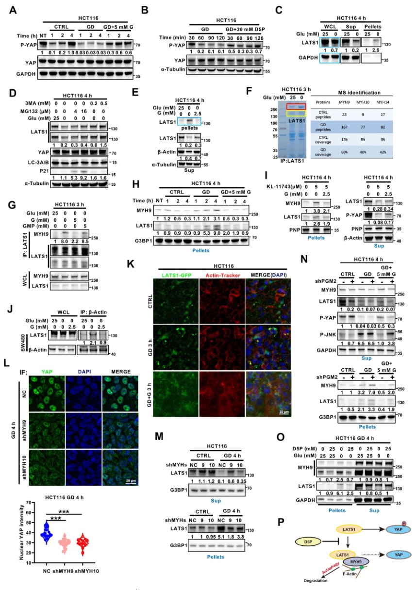 癌症代谢治疗新突破:D-核糖-5-磷酸如何“关闭”促癌蛋白YAP? 4 1751876784837_8106296.png