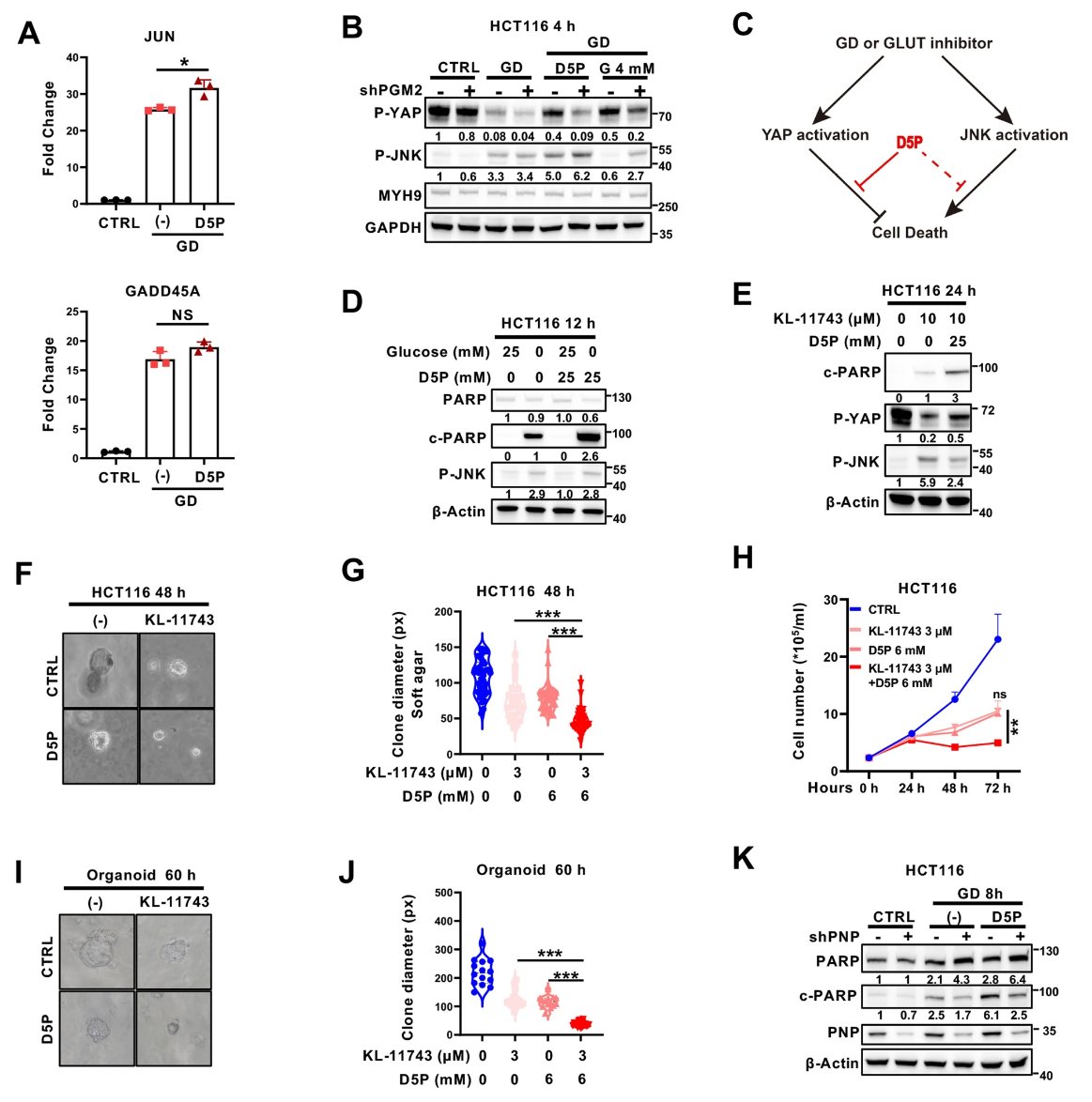 癌症代谢治疗新突破:D-核糖-5-磷酸如何“关闭”促癌蛋白YAP? 5 1751876839018_8106296.png