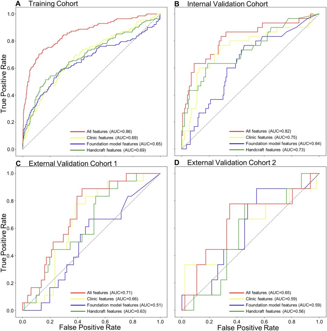 不同特征集预测DFS的ROC曲线和AUC值
