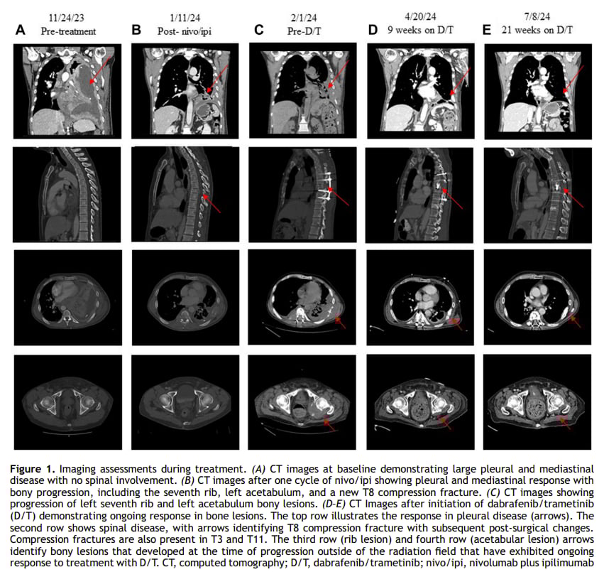 图1 治疗期间的影像学评估