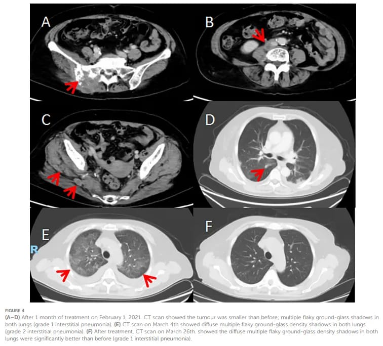 图3 影像学结果