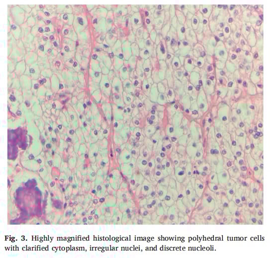 高倍放大组织学图像
