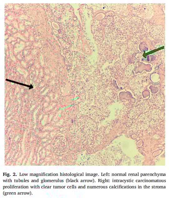 低倍组织学图像