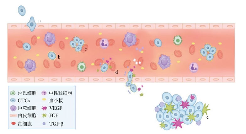 CTCs通过血流在肿瘤远处转移的分子作用机制