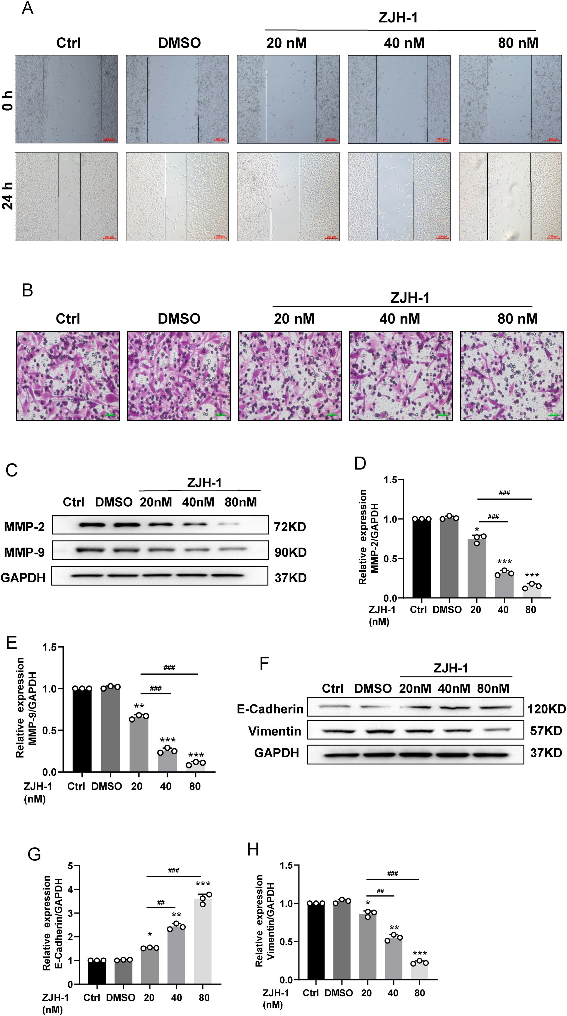 图4 ZJH-1有效抑制PC3细胞迁移、侵袭及上皮间质转化