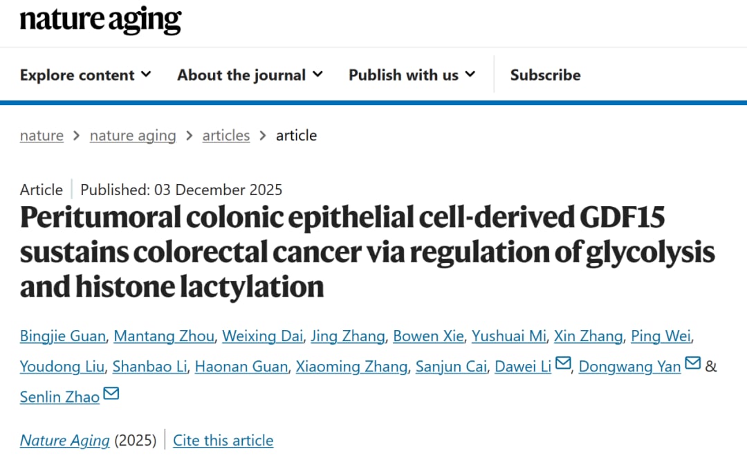 癌旁衰老细胞分泌GDF15促进肿瘤生长