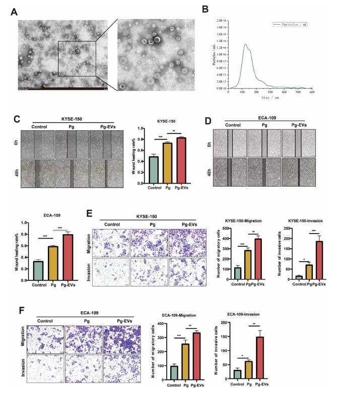 牙龈卟啉单胞菌胞外囊泡显著促进食管鳞癌细胞侵袭和迁移能力的细胞实验图