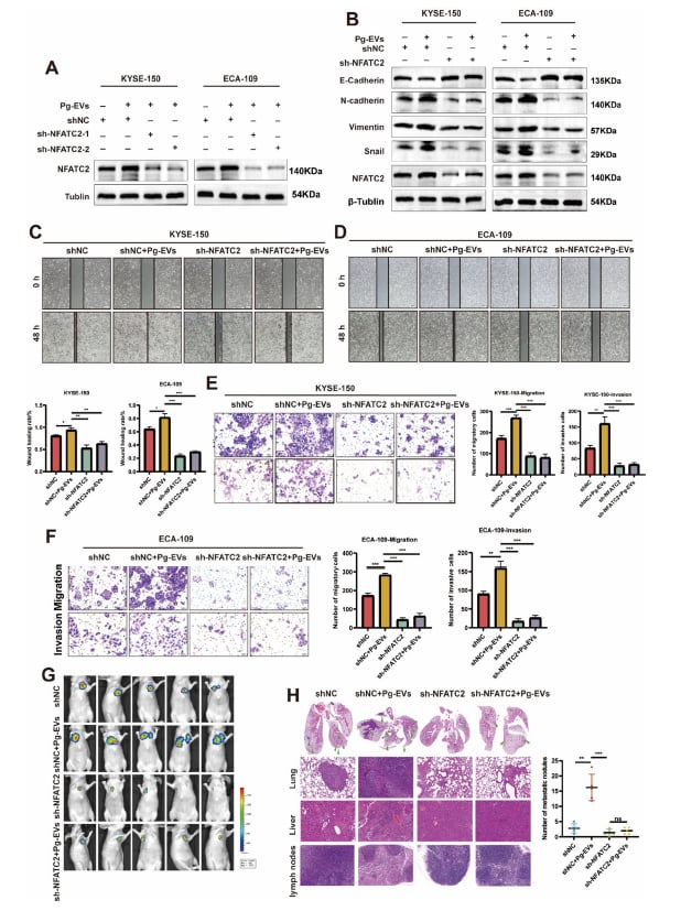 敲低NFATC2基因对牙龈卟啉单胞菌胞外囊泡介导的食管鳞癌侵袭和迁移能力影响的实验结果图