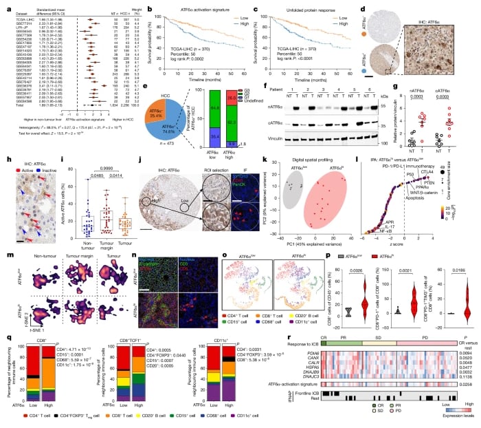 ATF6α激活水平与肝细胞癌患者预后及免疫治疗反应相关性图