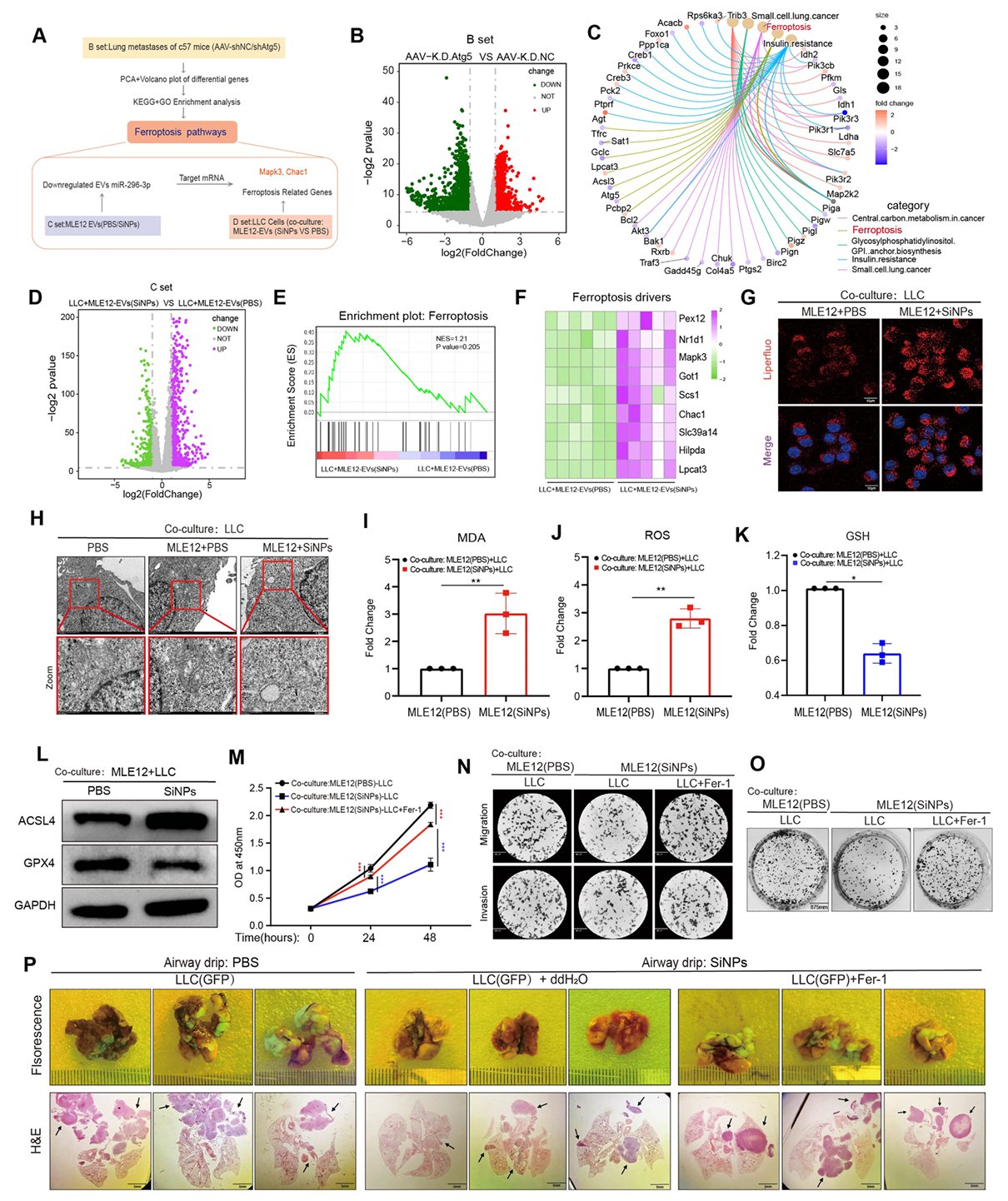 硅纳米颗粒调控肺癌细胞铁死亡机制的测序分析与功能验证结果