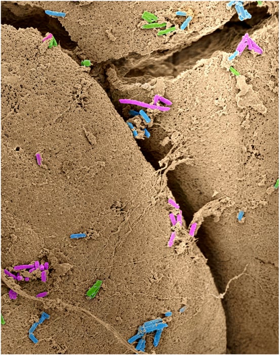 生态网络平衡指数(ENBI)在区分健康肠道与患病肠道中的应用示意图