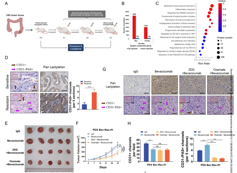 升高的乳酰化促进结直肠癌中血管生成拟态形成及对贝伐珠单抗的耐药性