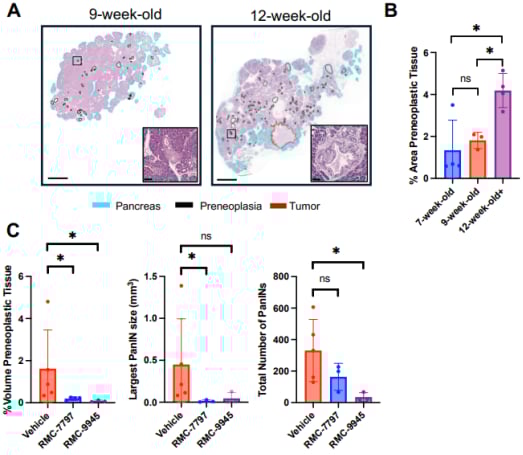 胰腺癌前病变PanIN早期干预与晚期治疗生存获益对比图