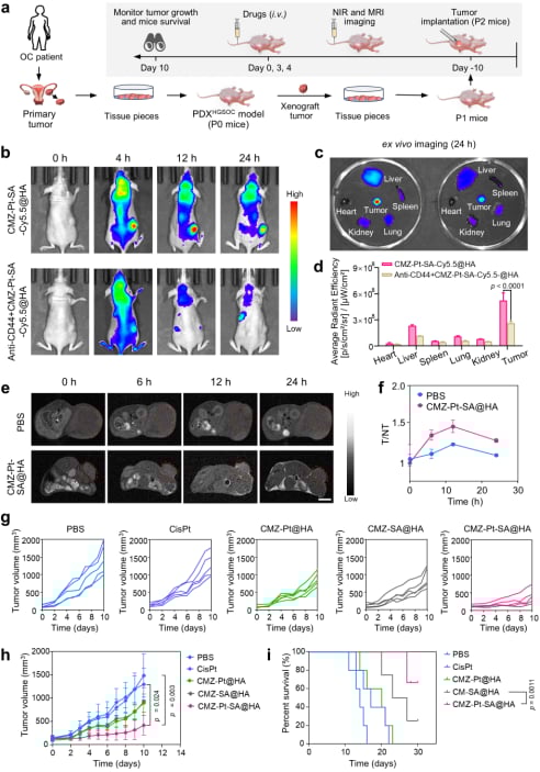 图7. CMZ-Pt-SA@HA在高级别浆液性卵巢癌患者源异种移植（PDXHGSOC）小鼠模型中的抗肿瘤作用。