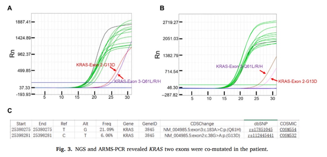 KRAS基因双外显子共突变患者的NGS与ARMS-PCR检测结果图，显示Q61H和G13D突变