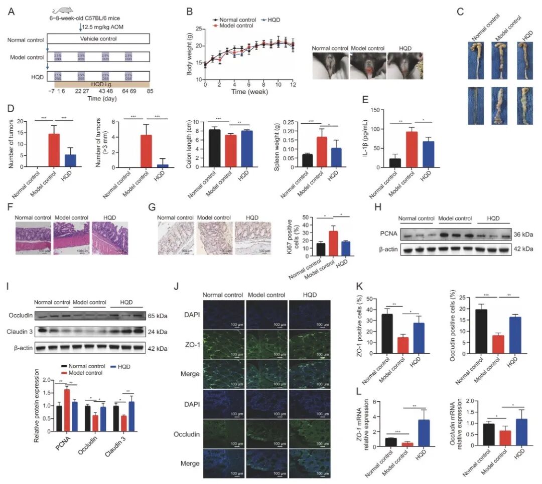 黄芩汤阻断结直肠炎癌转化小鼠肿瘤数量及炎症因子数据图