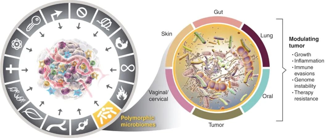 多态性微生物组影响癌症发生发展的通路图