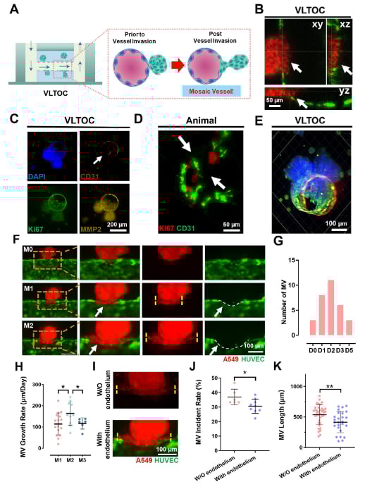 血管化肺肿瘤类器官芯片动态捕捉嵌合血管形成过程