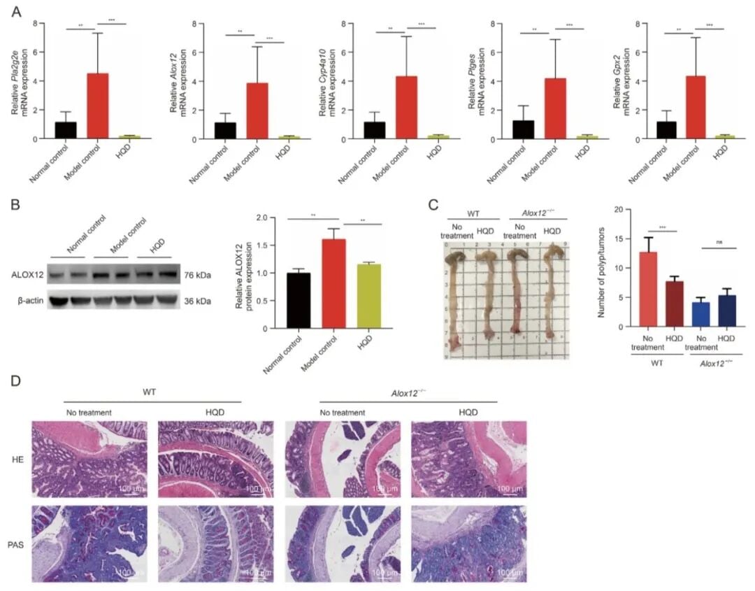 黄芩汤通过ALOX12抑制结直肠炎癌转化关键介导因子验证图