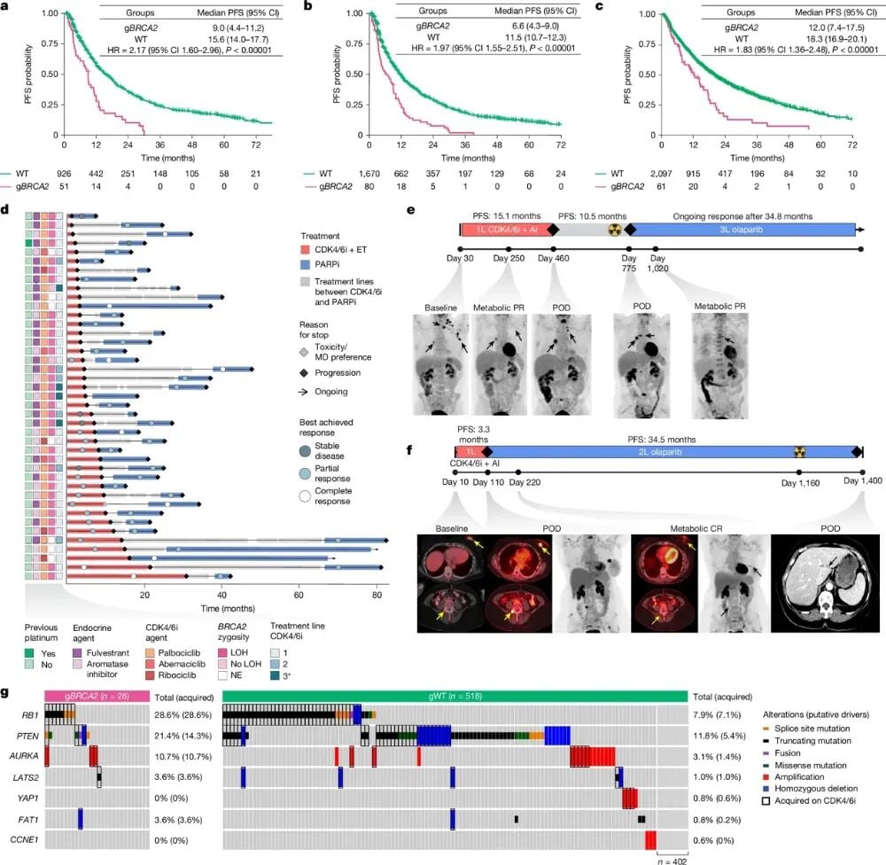 gBRCA2突变乳腺癌患者接受CDK4/6抑制剂与PARP抑制剂治疗的疗效对比图