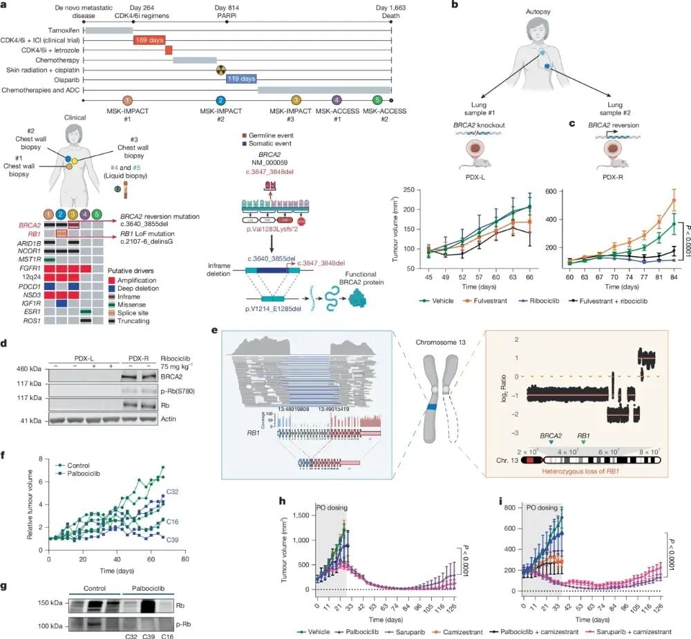 患者来源PDX模型验证RB1缺失作为耐药驱动因素及PARP抑制剂疗效的数据图