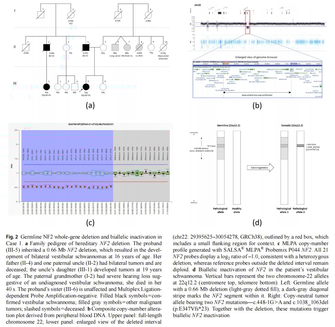NF2基因全基因缺失与双等位基因失活检测结果图