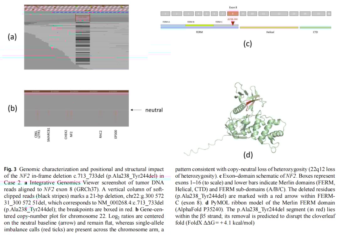NF2框内缺失对Merlin蛋白结构影响分析图
