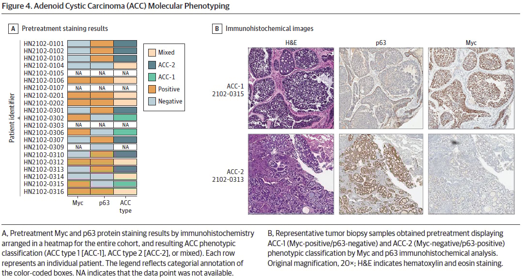 晚期腺样囊性癌患者的ACC-1和ACC-2表型分型及治疗反应图