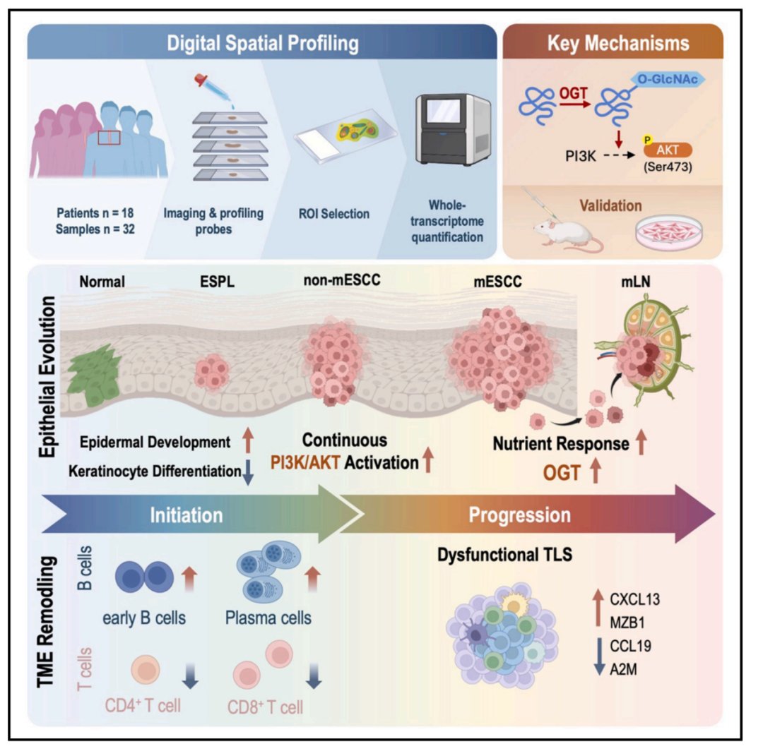 Cell Reports Medicine发表的食管癌空间组学研究概要：从癌前病变到转移的演化机制图