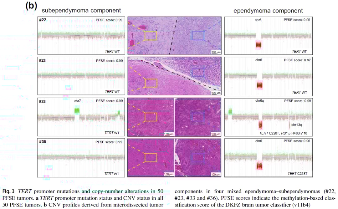 空间分布下的基因突变分析，揭示肿瘤内部异质性