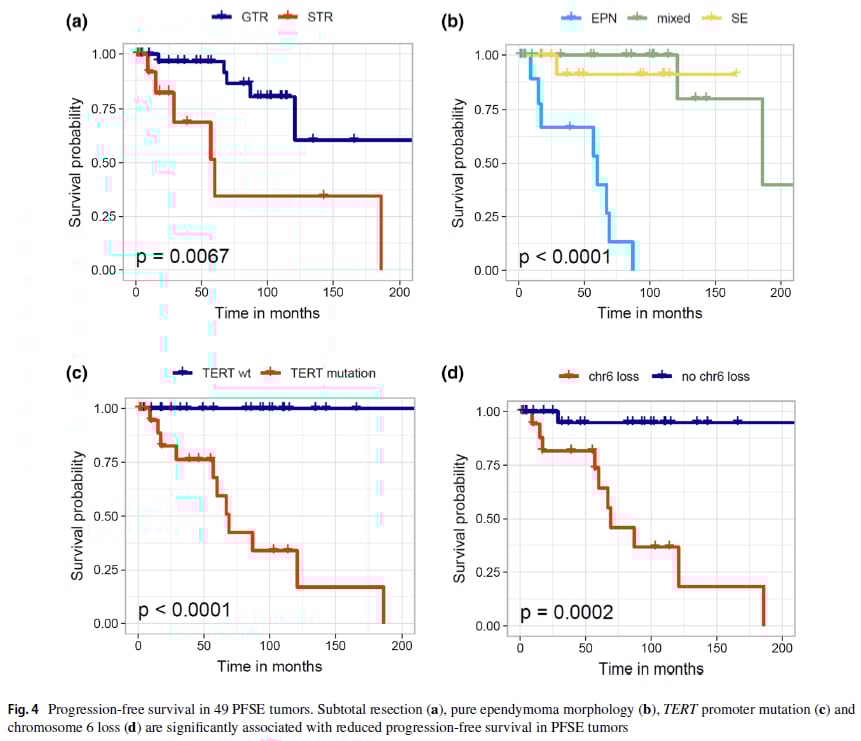 TERT突变与6号染色体缺失对患者无进展生存期的影响曲线