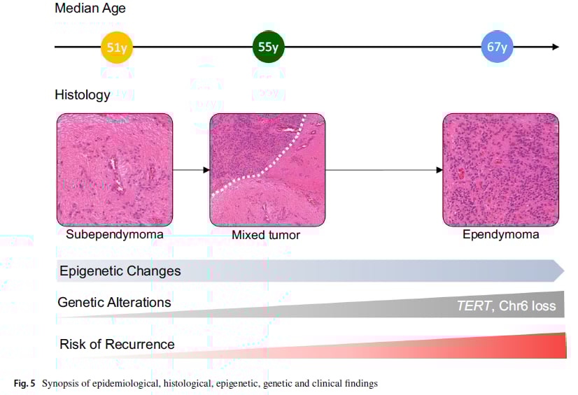 室管膜下瘤演变为室管膜瘤的分子生物学模型总结