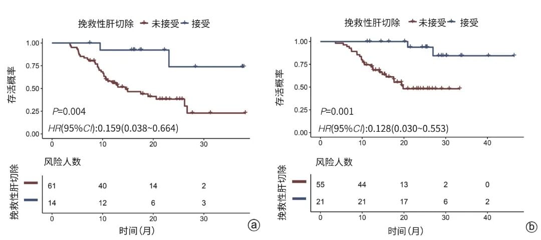 肝细胞癌高低IgG与IgM比值患者接受挽救性肝切除后的总生存获益