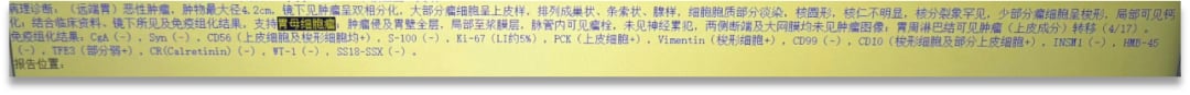 胃母细胞瘤患者病理诊断与分子检测评估流程示意