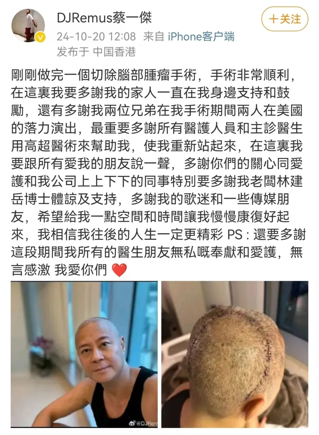 恶性脑胶质瘤术后切除伤口管理及居家防复发