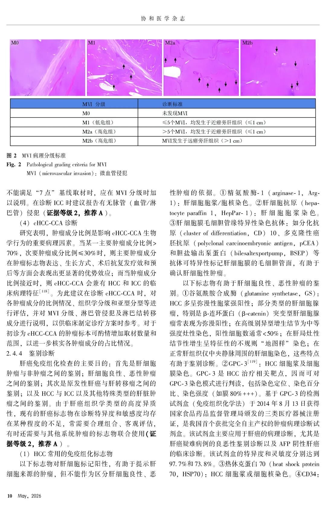 2026版原发性肝癌诊疗指南官方文献第10页