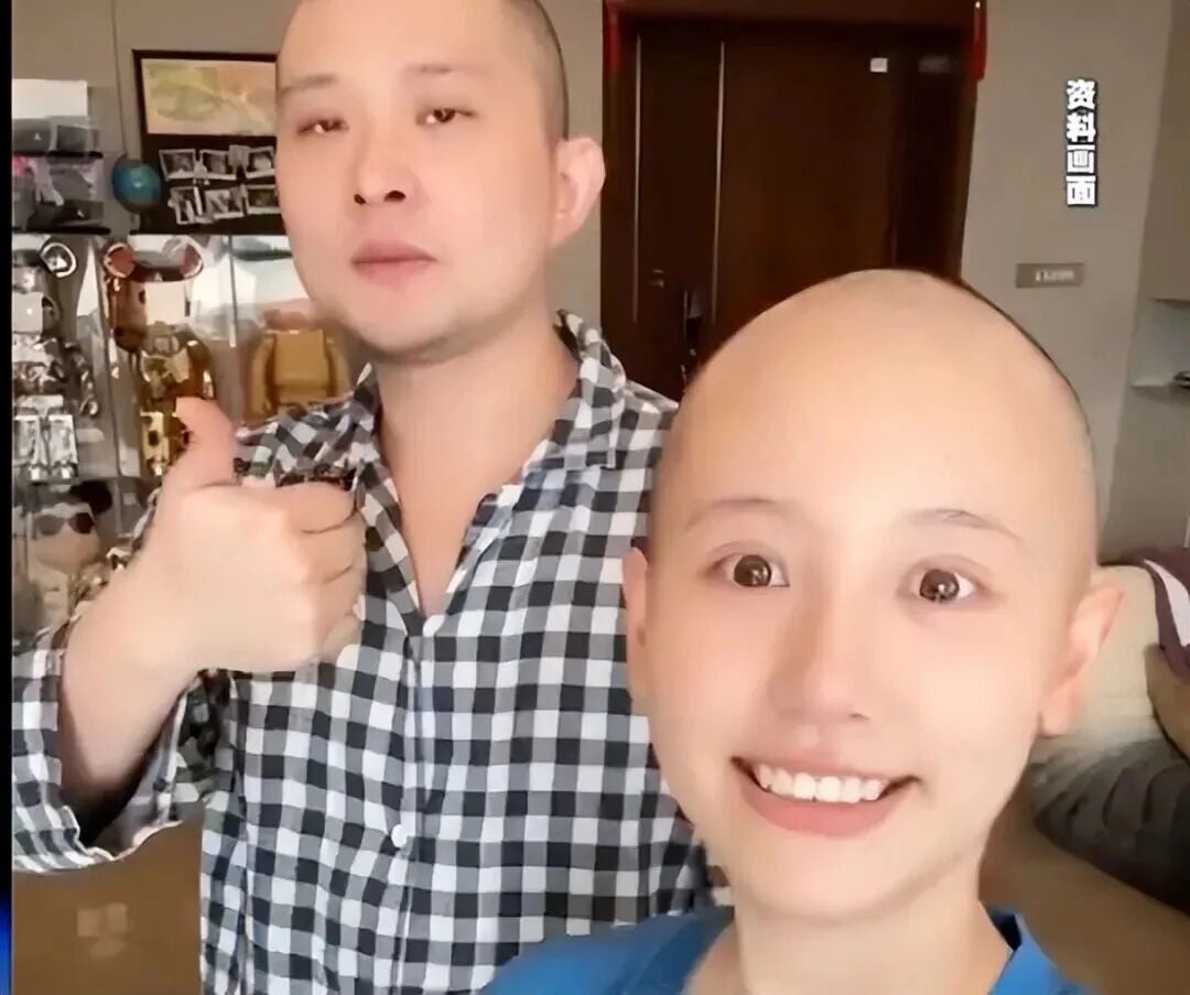 霍奇金淋巴瘤化疗期间脱发副作用与家属陪护护理