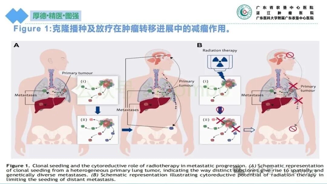 早期巩固放疗与耐药进展后放疗的生存曲线对比