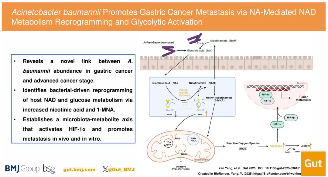 胃癌微环境中鲍曼不动杆菌促进癌细胞糖酵解和转移的示意图