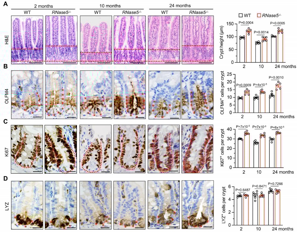 RNase5水平与肠道隐窝稳态及肠癌风险的负相关性数据图