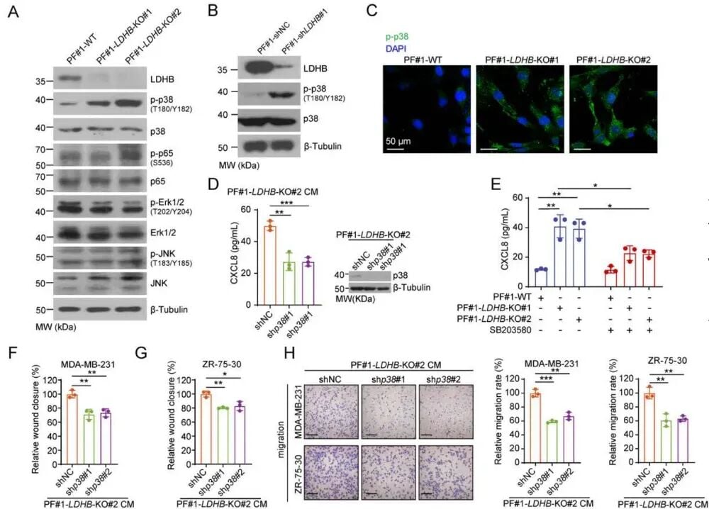 LDHB缺失激活p38 MAPK通路增强CXCL8表达导致肿瘤微环境重构