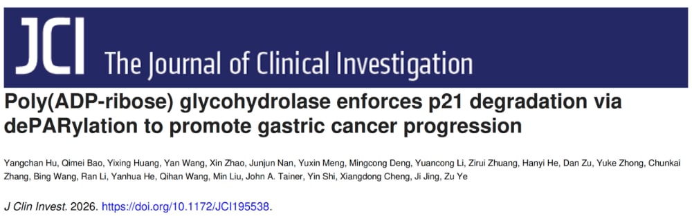浙江省肿瘤医院研究揭示PARG在胃癌中的异常高表达与患者不良预后呈正相关