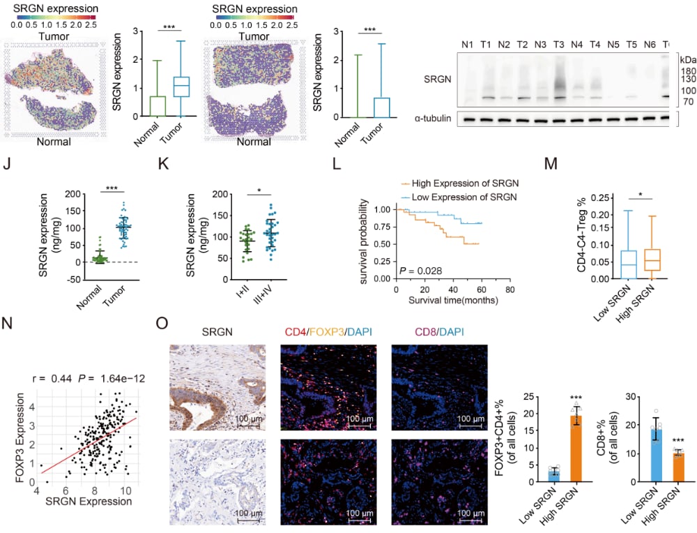 胃癌组织中Treg富集并与丝甘蛋白聚糖水平相关的研究图示