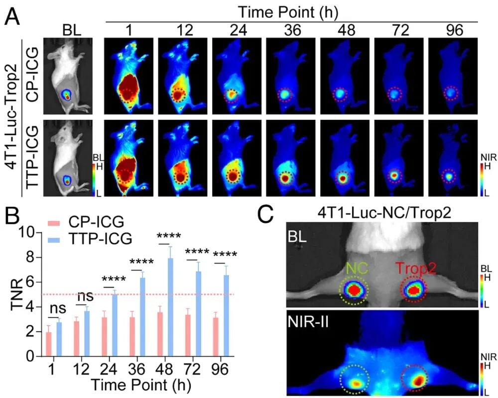 TROP2靶向NIR-II荧光成像用于乳腺癌切缘和前哨淋巴结识别示意图