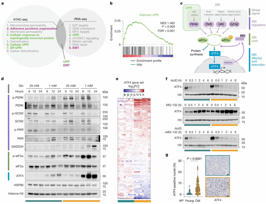 老年肿瘤中UPR-ISR-ATF4持续激活示意图：衰老相关表观遗传改变诱导应激反应通路