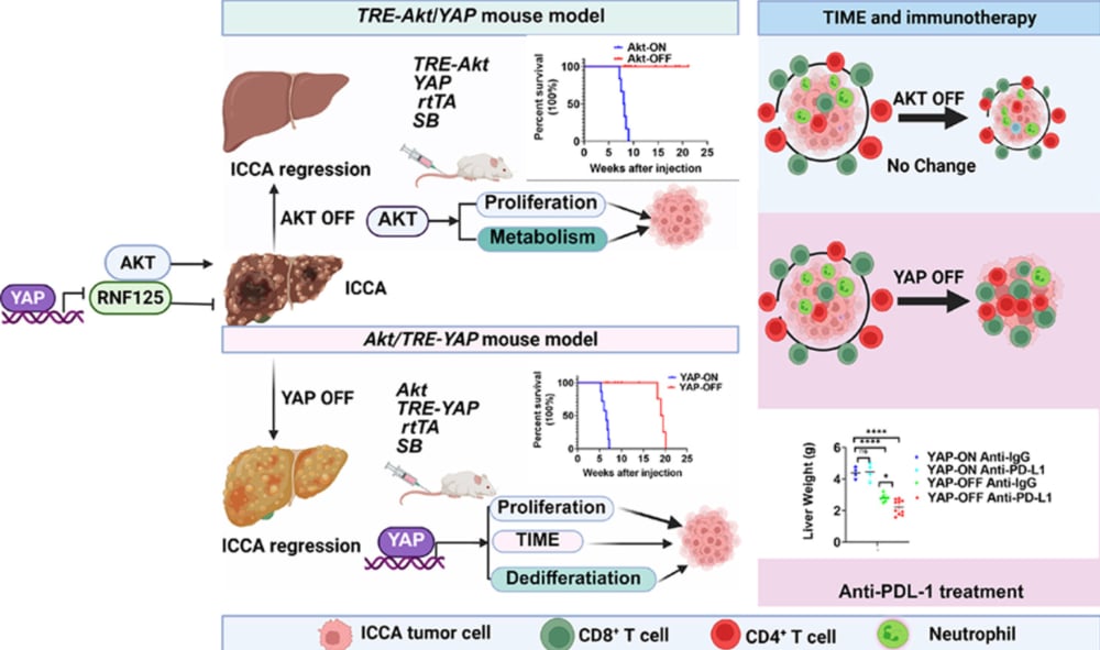 肝内胆管癌中AKT与YAP信号驱动肿瘤进展及免疫抑制的模式机理图
