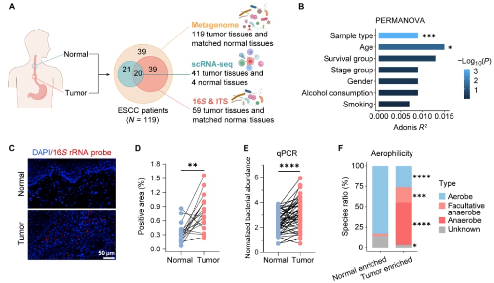 食管鳞状细胞癌患者肿瘤组织与正常组织微生物组特征对比及预后分析