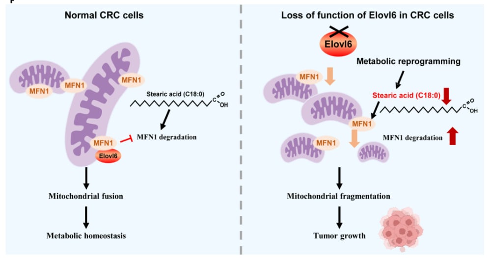 Elovl6通过硬脂酸介导线粒体融合及代谢重编程抑制结直肠癌的机制模式图