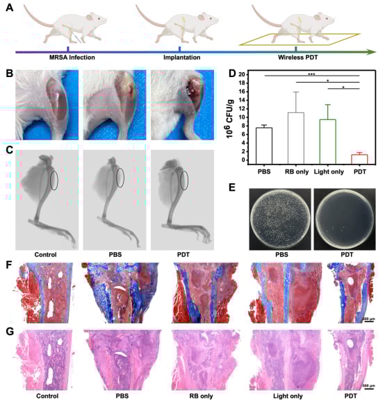 骨肉瘤等深部肿瘤治疗新希望:柔性可植入光子器件实现无线光动力疗法 3 图片